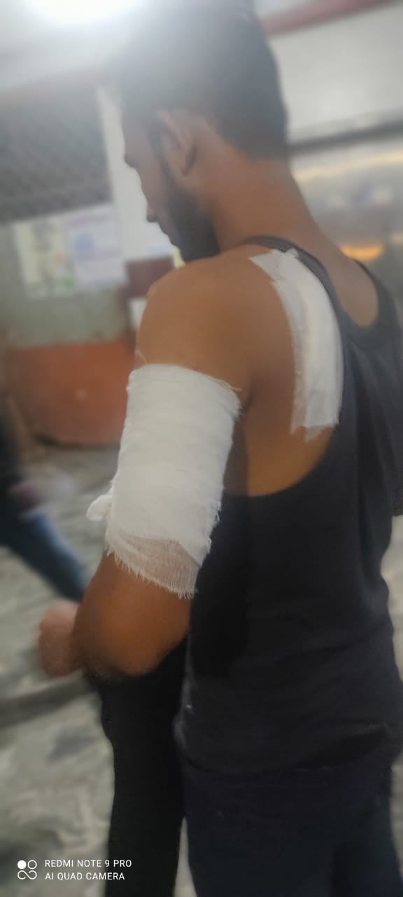 কাপ্তাই রাস্তার মাথায় সিএনজি ড্রাইভারকে ছুরিকাঘাত