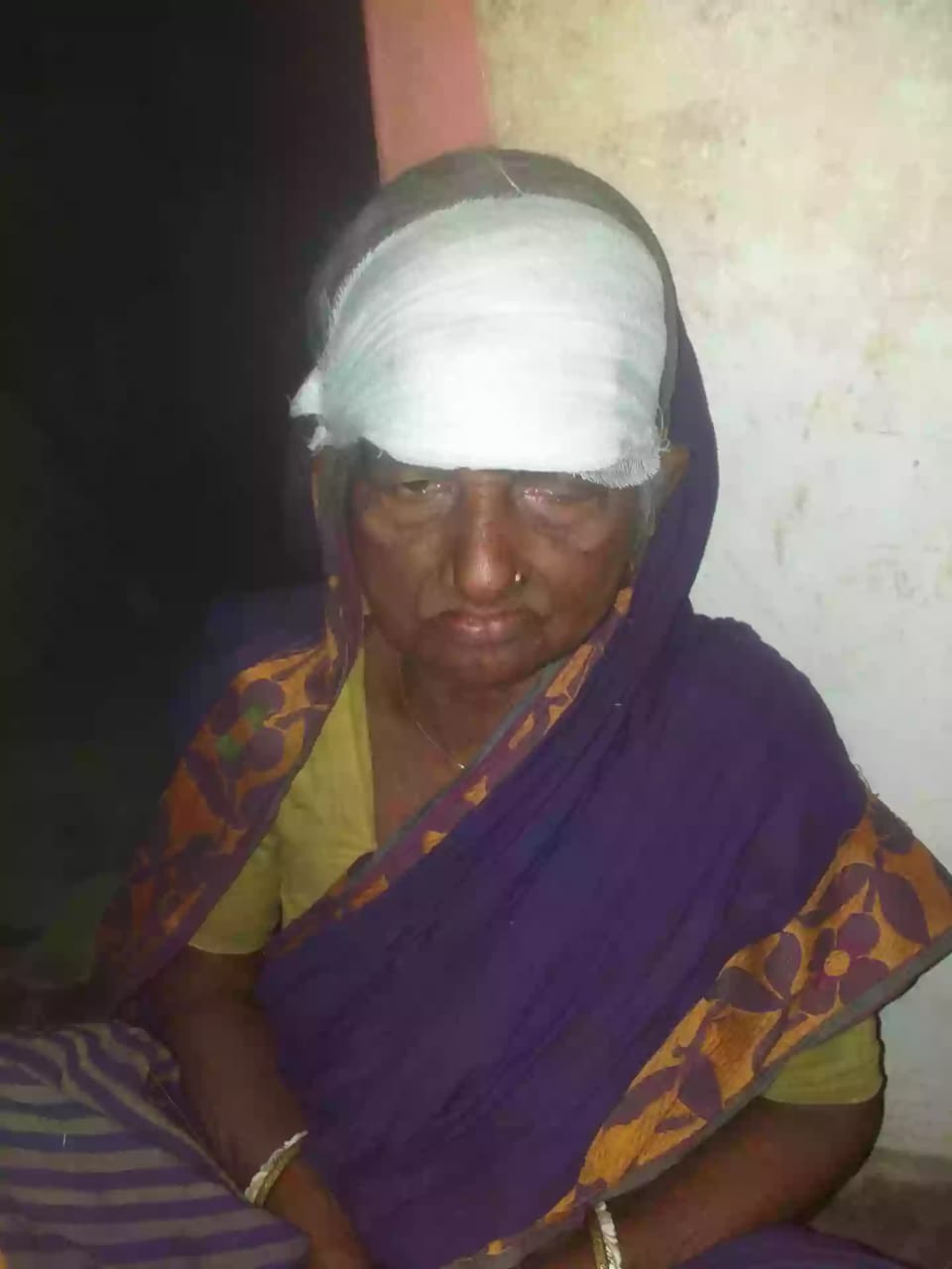 আনোয়ারায় ভূমি নিয়ে সংঘর্ষে ৭২ বছরের বৃদ্ধাসহ আহত ৩