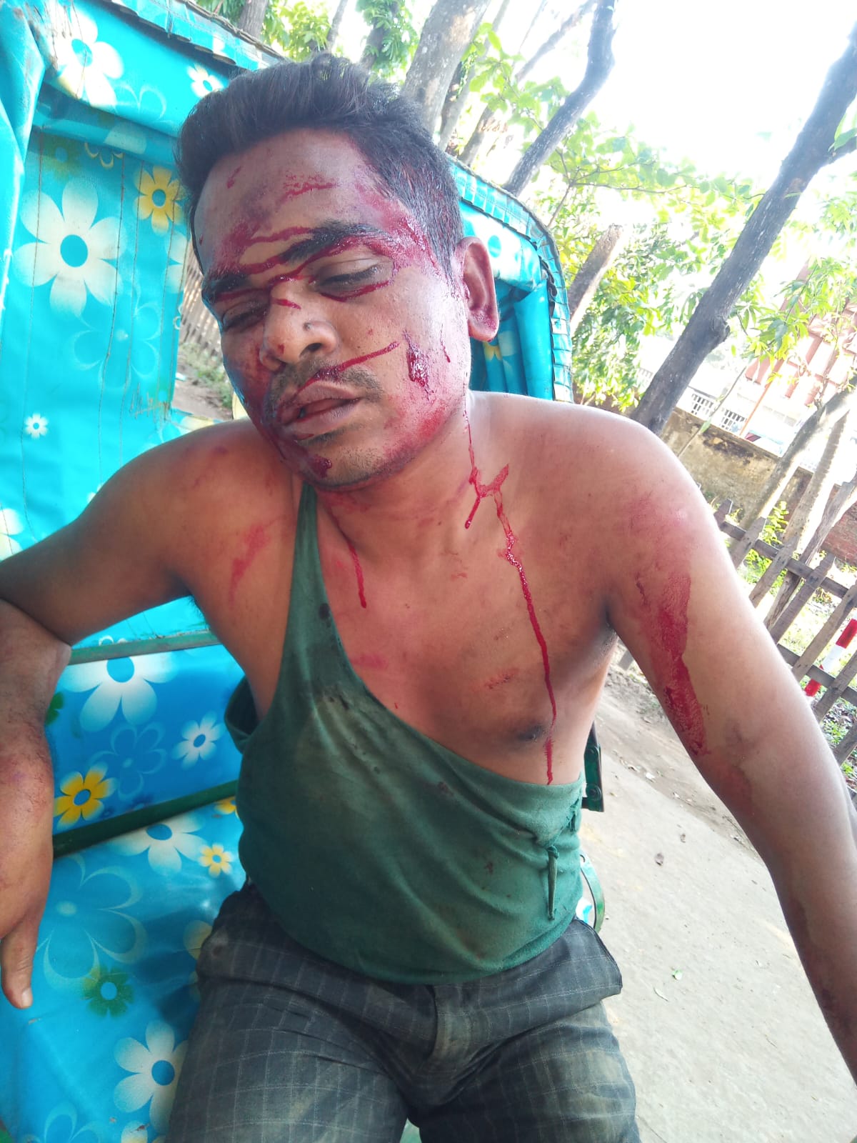চন্দনাইশ দোহাজারীতে সন্ত্রাসী হামলায় সাংবাদিক আয়ুব মিয়াজী গুরুত্বর আহত