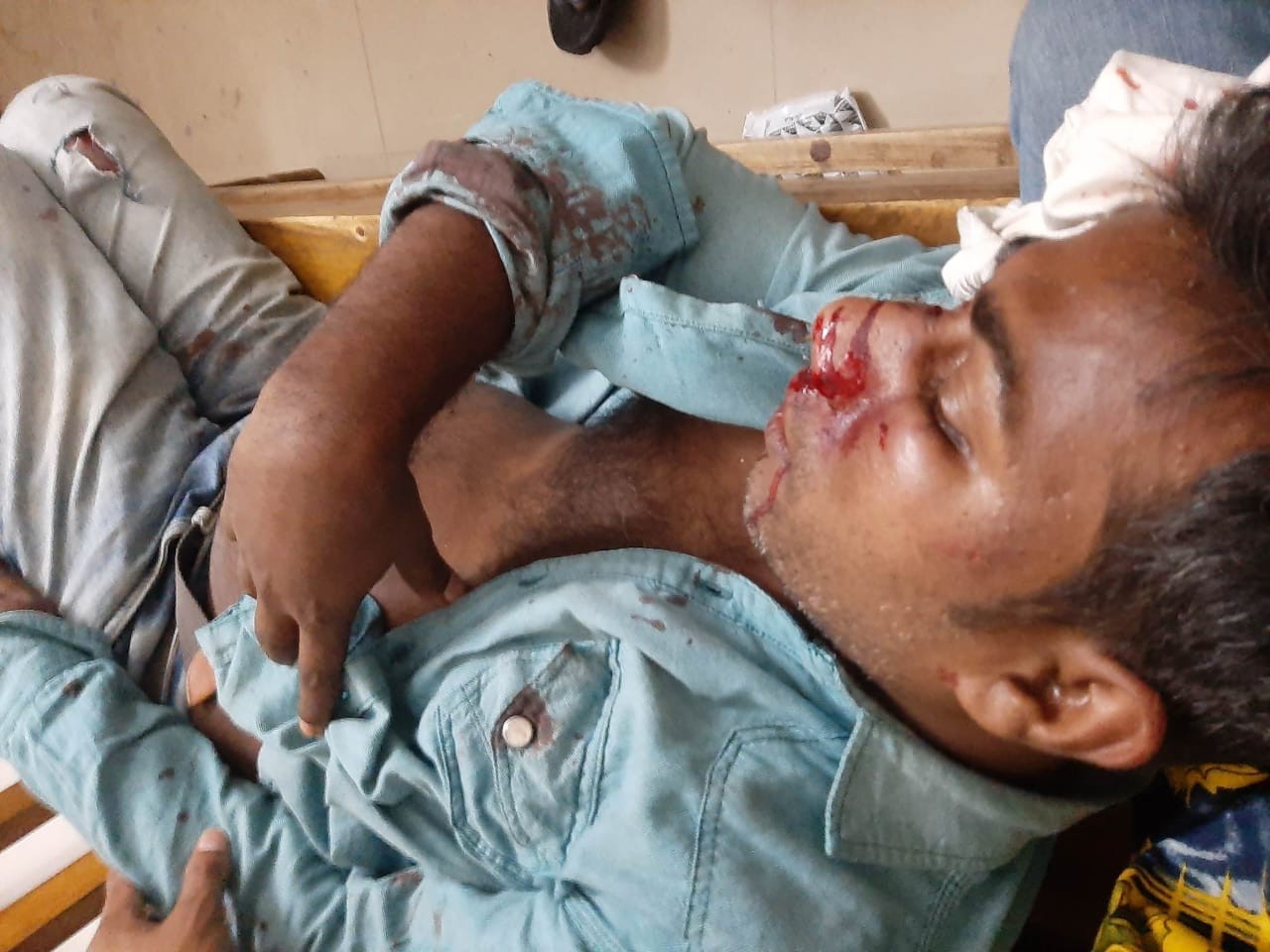 সন্দ্বীপের বিভিন্ন স্থানে সন্ত্রাসী বাহিনীর হামলা ও গুলিবর্ষণ