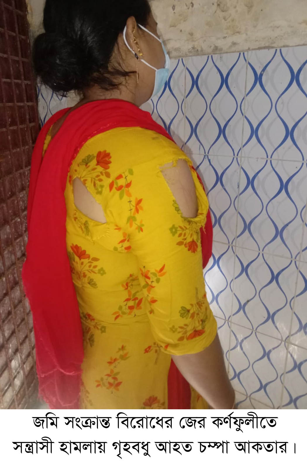 জমি সংক্রান্ত বিরোধের জের কর্ণফুলীতে সন্ত্রাসী হামলায় গৃহবধু আহত    