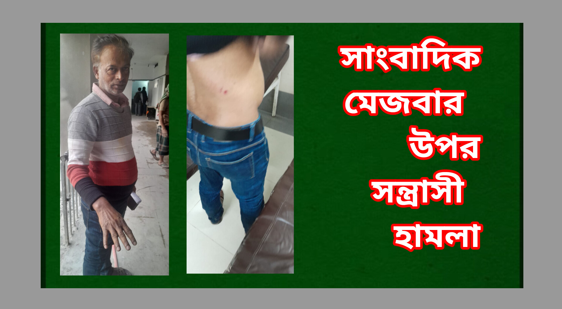 সাংবাদিক মেজবার উপর সন্ত্রাসী হামলা