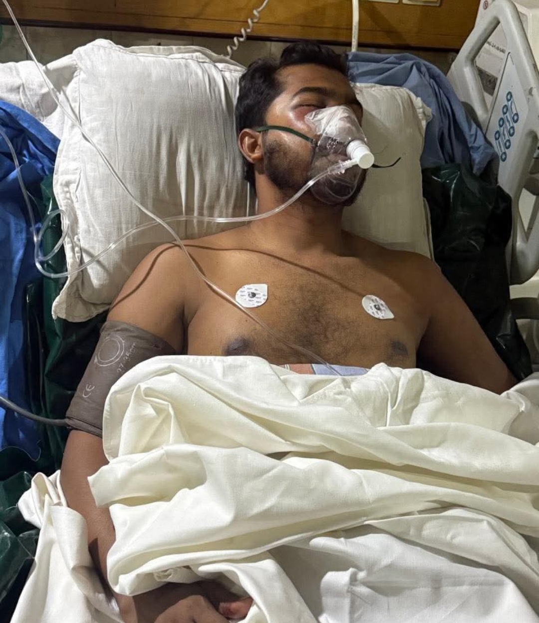 আইসিইউতে ভিপি নুর